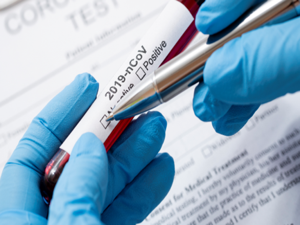 08052020_TestagemCovid-19_ID950x650
